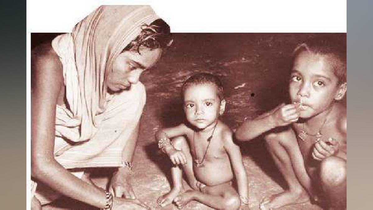 Ashish Shelar laments the plight of malnourished children in Mumbai suburbs Mumbai news