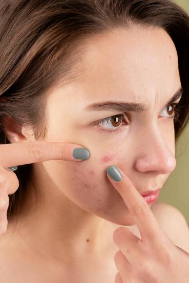 You’ll Never Guess What Green Chilies Can Do for Your Skin know how are green chillies beneficial for skin in different ways