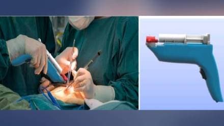 Technology transfer of Skin Spray Gun developed by COEP Pune news