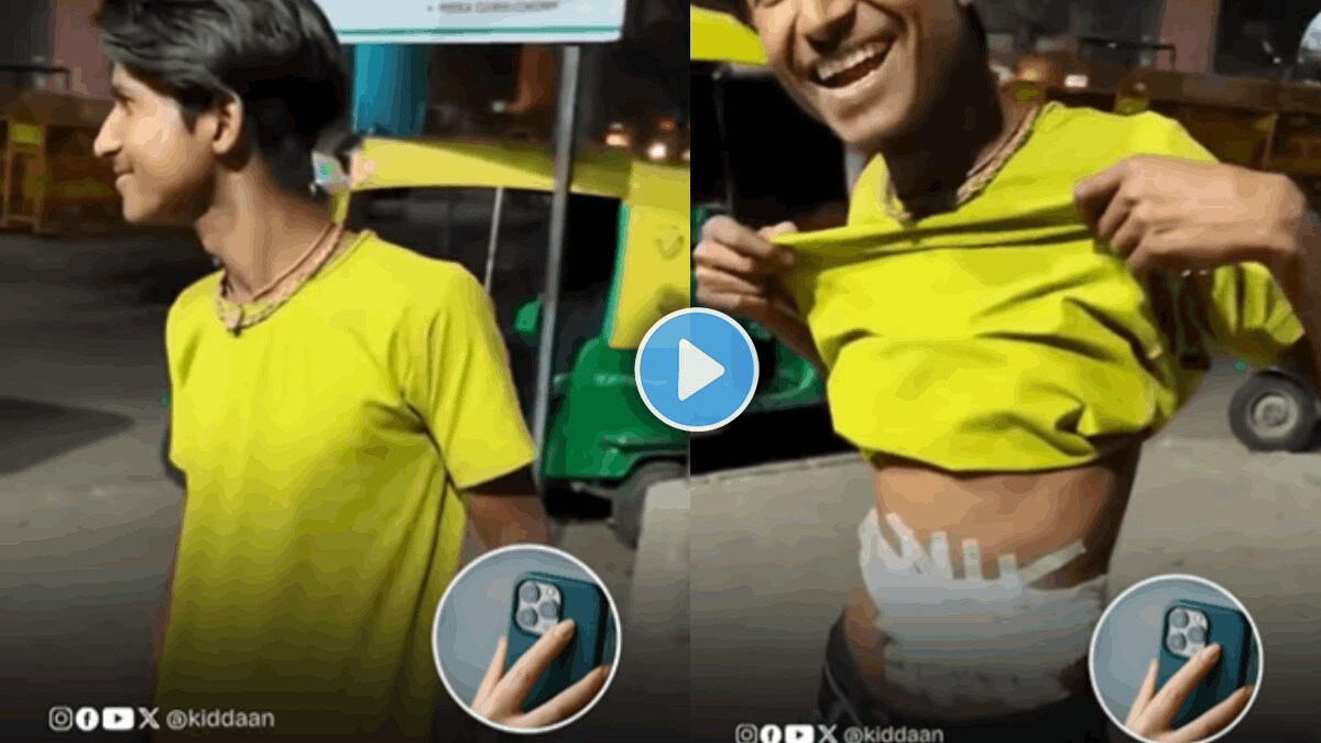 youn man sold his kidney to impress girlfriend