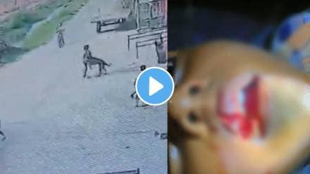 Shocking video Rabies Infected Stray Dog Attacks 8-Year-Old Boy, Bites Off His Lips In UP's Meerut