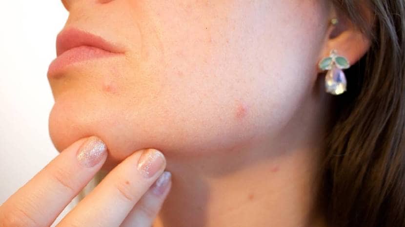What Is The Best Skincare For Pimples