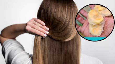 Hair care 5 Benefits Of Mango Seeds For Skin, Hair, Weight Loss And More Hair Growth tips