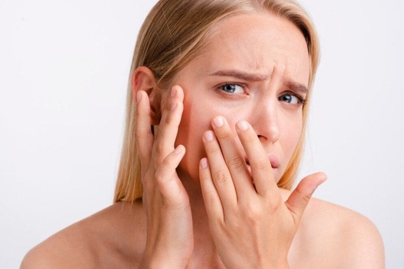 rice water acne pores
