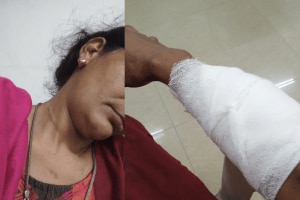 In the Avantika Express on Western Railway, a woman from Thane was attacked with a sharp weapon by a minority community woman and a male co-passenger attack