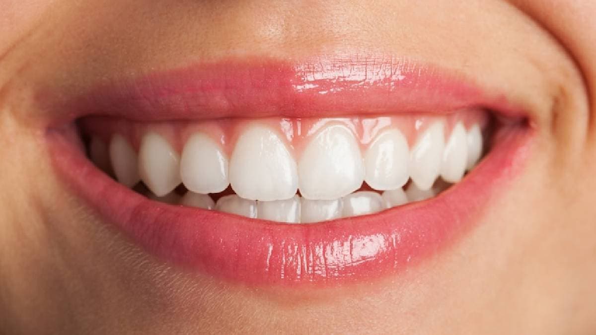 How to Get Rid of Yellow Teeth