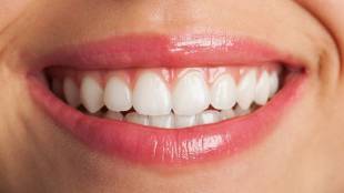 How to Get Rid of Yellow Teeth