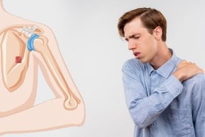 Best foods to reduce uric acid