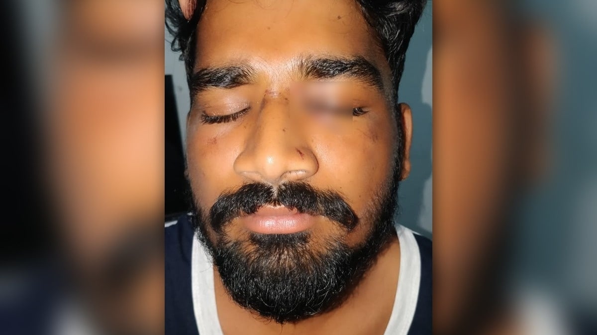 nagpur tree branch hit eye