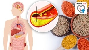 signs of high cholesterol