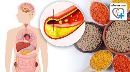signs of high cholesterol