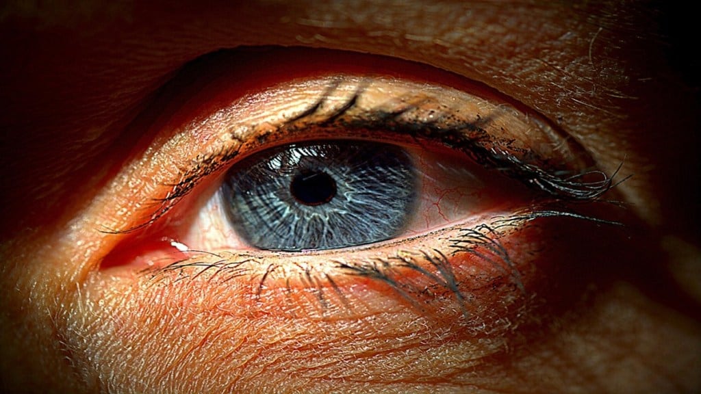 Government Medical Hospital Chandrapur, eye surgery patient died Chandrapur, Chandrapur eye surgery ,
