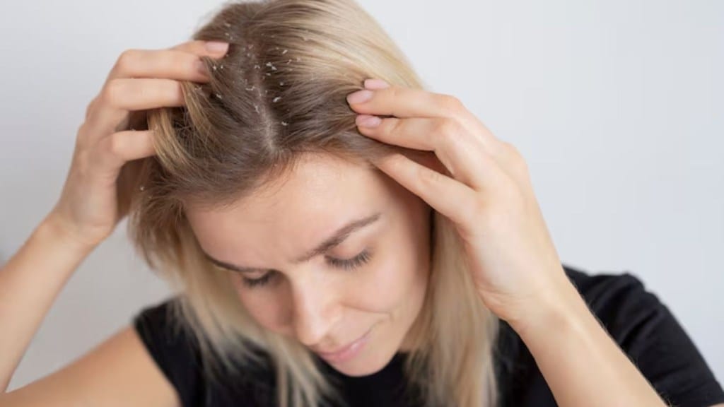 hair care in rain, hair care tips, monsoon season