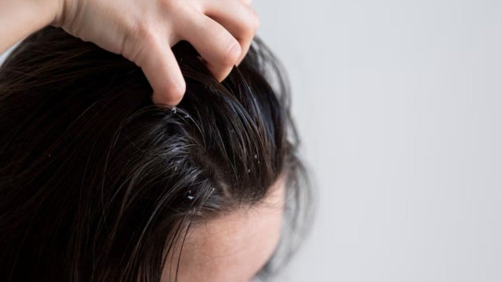 hair care in rain, hair care tips, monsoon season