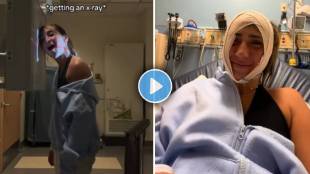 Jenna Sinatra jaw stuck after yawning video viral