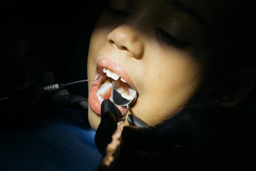 Say Goodbye to Tooth Decay Try These Powerful Home Remedies Today