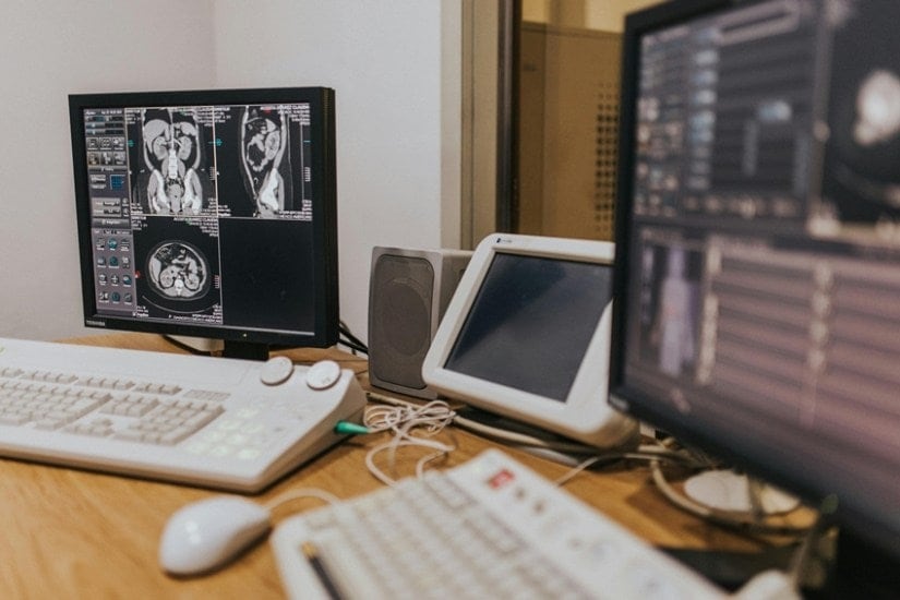 Scoliosis Awareness Lags Despite Rising Cases in Teens