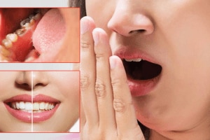 Oral health teeth cavity bad breath yellow teeth's start eating dairy products fruits