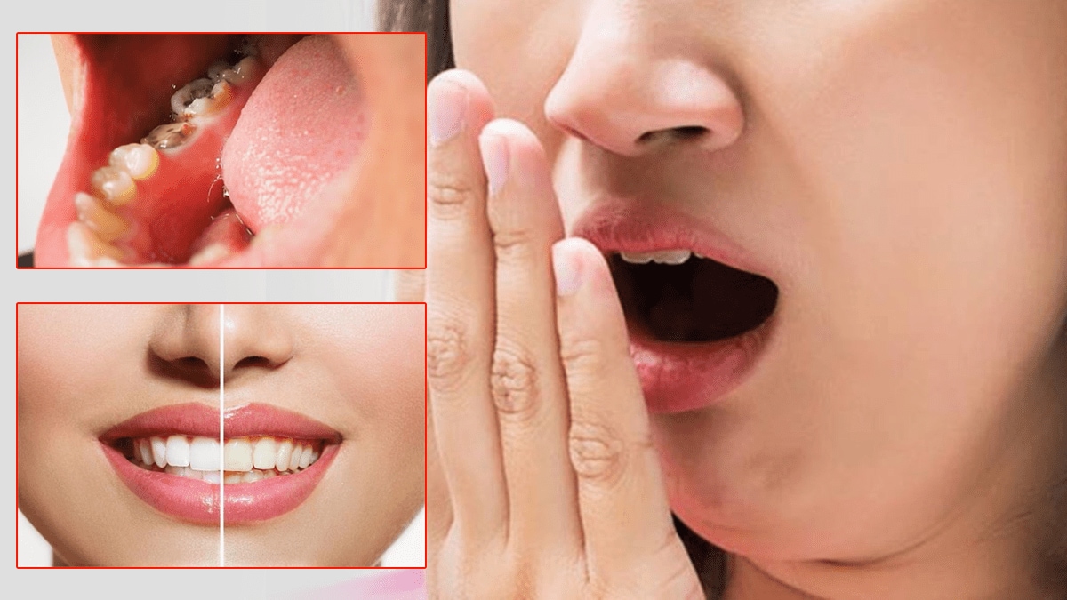 Oral health teeth cavity bad breath yellow teeth's start eating dairy products fruits
