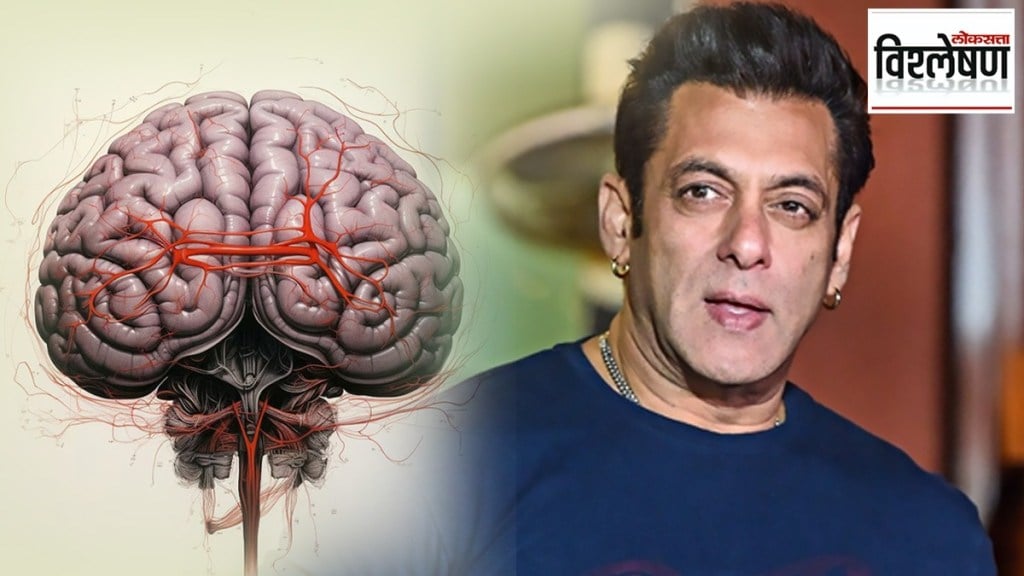 salman khan brain diseases