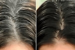 white hair solution remedy to turn white hair black Mustard oil ayurveda