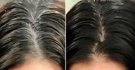 white hair solution remedy to turn white hair black Mustard oil ayurveda